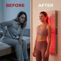 Red Light Therapy Panel Device – Full Body Panel, 630Nm 660Nm 810Nm 850Nm Red & near Infrared Light Therapy, 300 Quad Chip Leds, Brightness Control, Pulse Mode – ULTRA1500 — Before & After